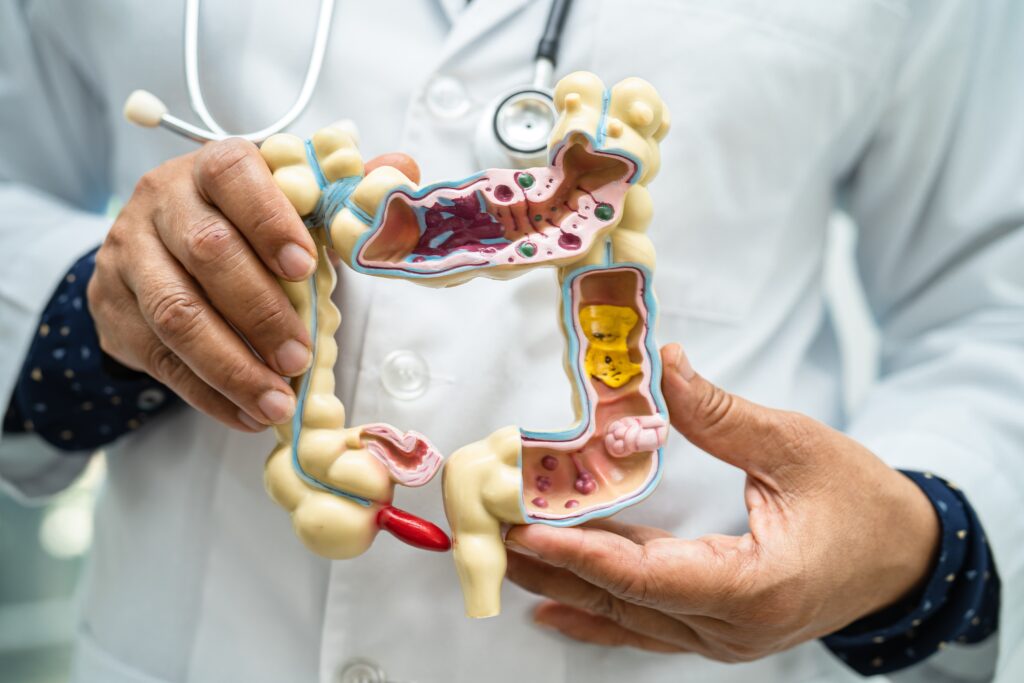 Manuscript: NSAID-Induced Leaky Gut