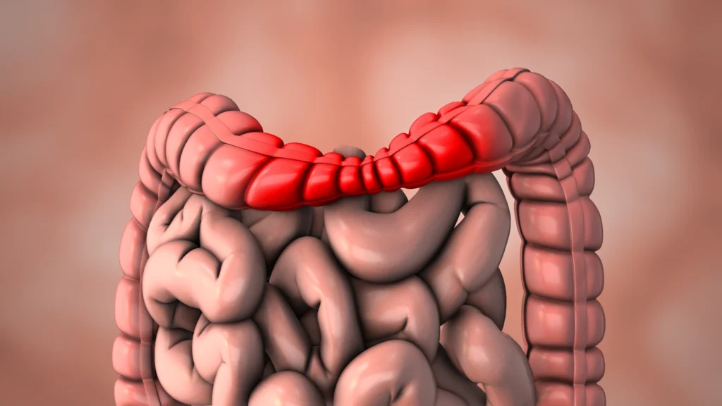 Medical animation of the irritable bowel syndrome 3D Illustration